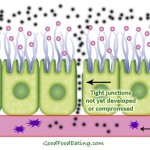 Do you have a leaky gut?