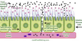 Do you have a leaky gut?