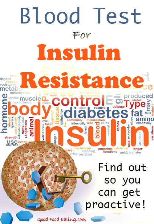 Blood Test For Insulin Resistance / PreDiabetes