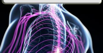 Type 2 Diabetes and Inflammation