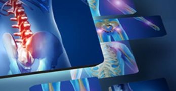 GFE Podcast #72: List of Inflammatory Diseases