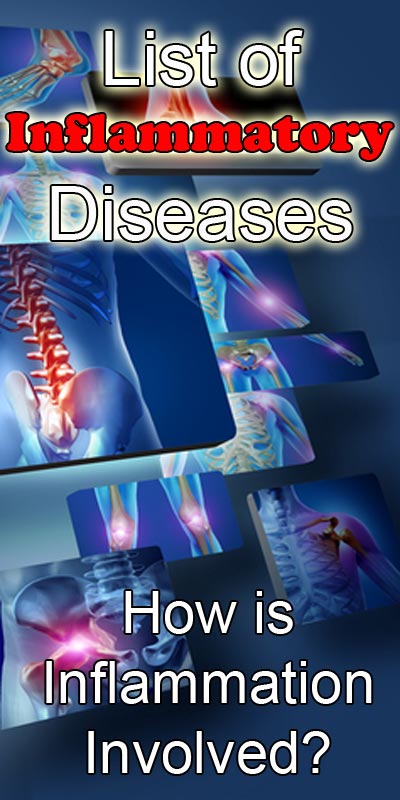 List of Inflammatory Diseases