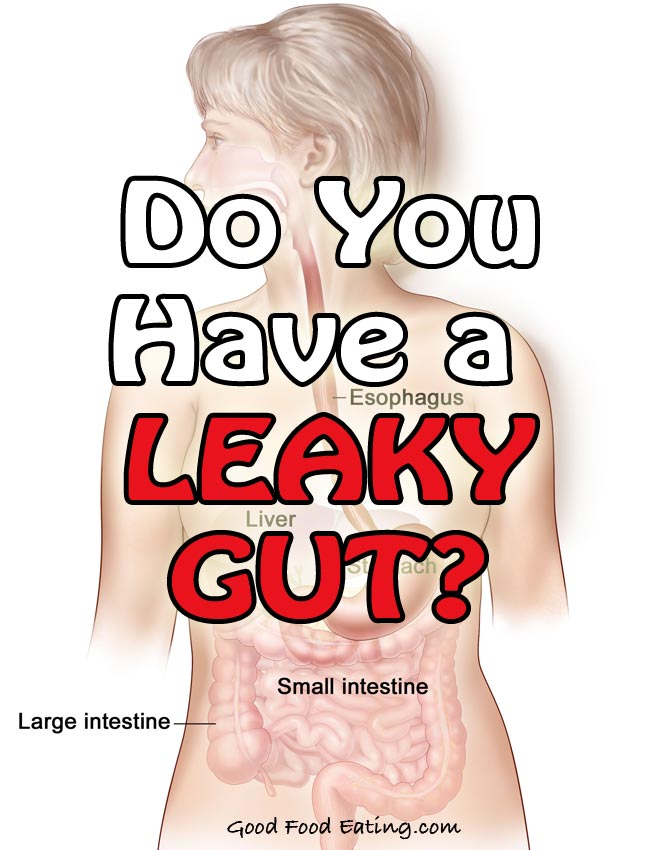 Do You Have a Leaky Gut?